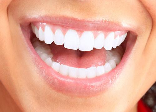 Close up of patient's smile at dentist near me Tampa