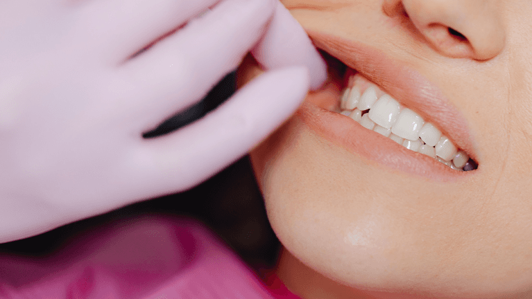 Gum Treatment Application