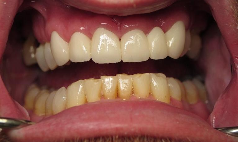 Cosmetic-Dentistry-After-Image