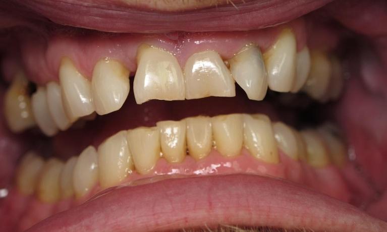 Cosmetic-Dentistry-Before-Image